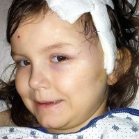 Anak Baru Umur 6 Tahun Sudah Kena Stroke