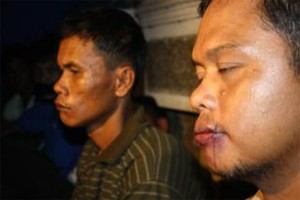 Tuntutan Tak Digubris, Petani Padang Lawas Jahit Mulut