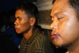 Tuntutan Tak Digubris, Petani Padang Lawas Jahit Mulut