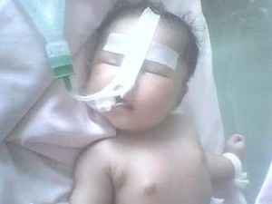 Terkumpul Rp 20 Juta untuk Diva, Bayi Penderita Jantung Bocor
