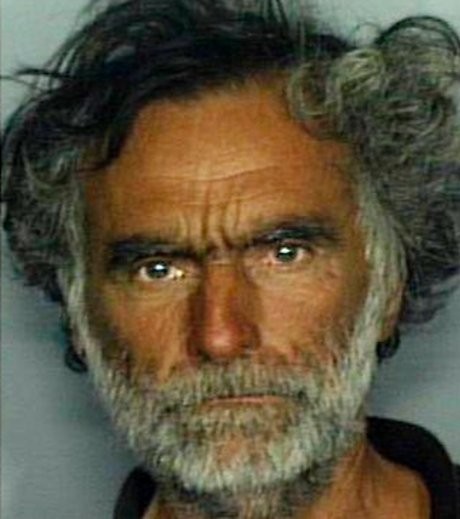 Wajahnya Dimakan Pria Bugil, Gelandangan AS Mulai Pulih Tapi Bakal Buta