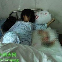 Gambar Aborsi Paksa yang Menggemparkan China