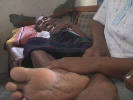 16 Warga Bogor Diduga Terjangkit Cikungunya