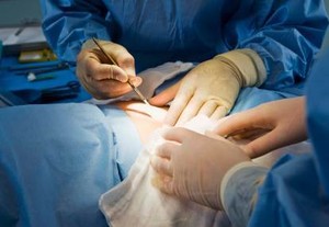 Tidak Boleh Lakukan Operasi di Klinik