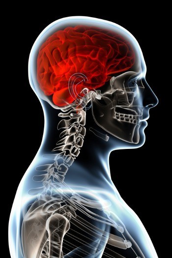 Selebritas yang Tertonjok Stroke