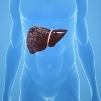 Tidak Timbulkan Gejala, Hepatitis Sulit Dideteksi