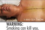 6 Gambar Seram Baru di Bungkus Rokok AS