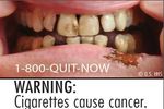 6 Gambar Seram Baru di Bungkus Rokok AS