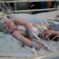 Si Bayi yang Menanti Donor Jantung agar Bisa Bertahan Hidup