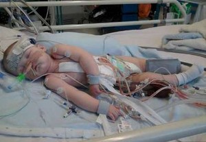 Si Bayi yang Menanti Donor Jantung agar Bisa Bertahan Hidup