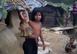 Gizi Buruk Serang Anak-anak Pengungsi Rohingya
