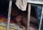 Gizi Buruk Serang Anak-anak Pengungsi Rohingya