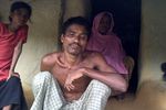 Pengungsi Rohingya di Kutupalong Memprihatinkan
