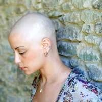 Studi: Kemoterapi Dorong Pertumbuhan Kanker