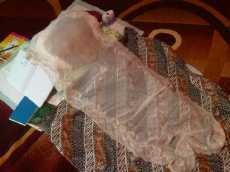 Dilla, Balita Pengidap Hidrosefalus Itu Meninggal di Pangkuan Ortu