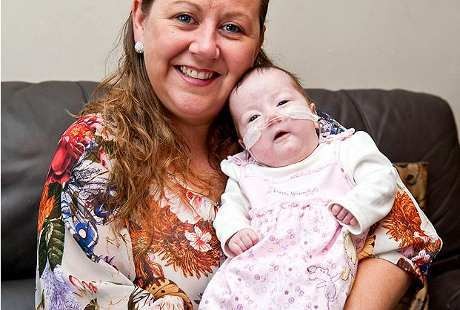 Dikira Sudah Meninggal, Bayi Ajaib Ini Mampu Bertahan Hidup