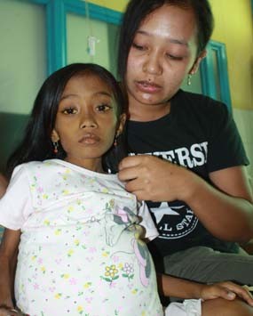 Derita Bocah 7 Tahun Terkena Radang Saluran Empedu