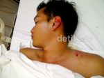 Kecelakaan Moge, Rezky Aditya Terbaring di Rumah Sakit