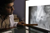 Laki-laki 60 tahun asal Multan, Pakistan mendatangi Nishtar Hospital dengan keluhan yang agak janggal, sejanggal hasil pemindaian dengan sinar X. Sebotol minuman bersoda merek Pepsi terjebak di anusnya, konon dimasukkan secara paksa oleh seorang penjahat yang kepergok akan mencuri 2 ekor sapinya. (Foto: Reuters)