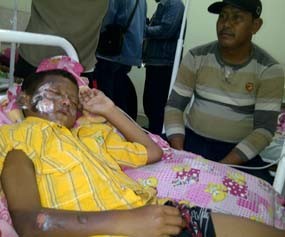 Asyik Main Mercon, 6 Bocah SD Terkena Luka Bakar