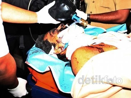 Thorik Menyerahkan Diri, Siapa Tersangka Bom Depok di RS Polri?