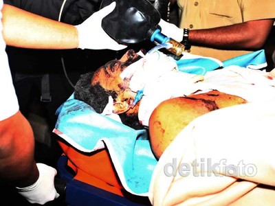 Tersangka Bom Depok Dievakuasi ke RS Polri