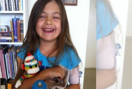 Tulang Tengkorak Bocah Ini Terlalu Kecil untuk Otaknya