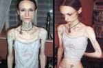 Perempuan-perempuan yang Kurusnya Kelewatan