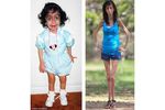 Perempuan-perempuan yang Kurusnya Kelewatan