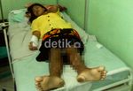 Aneh! Tubuh Supiyati Dipenuhi Jarum & Paku