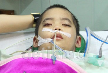Abi, Bocah yang Terus Berjuang untuk Bangun dari 66 Hari Komanya