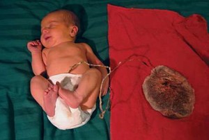 Melahirkan ala Lotus Birth, Banyak Plusnya atau Minusnya?