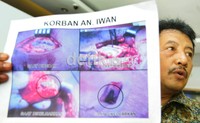 Mereka juga menunjukan gambar luka proyektil korban dalam kasus yang disangkakan kepada Kompol Novel Baswedan. Ramses/detikcom.