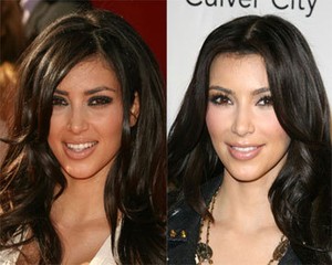 Wajah Kim Kardashian Sebelum & Sesudah Operasi Plastik