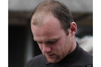 Meski selalu jadi bintang lapangan karena jago menyarangkan gol, penyerang tim sepakbola nasional Inggris, Wayne Rooney sering tidak percaya diri dengan rambutnya yang botak. Sampai-sampai di usianya yang baru 26 tahun, ia rela bayar mahal untuk menjalani terapi transplantasi atau cangkok rambut. (Foto: Huffingtonpost)