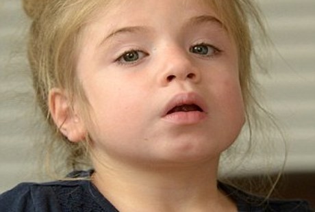 Bocah Manekin yang Tak Bisa Bergerak Akibat Gangguan Langka