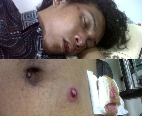 Kapolres Jaksel Jenguk Korban Bentrok Universitas Pamulang