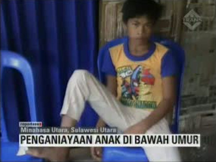 Bocah Dianiaya dan Dicabut Kukunya