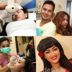 Tren Sulam Wajah Selebriti Indonesia