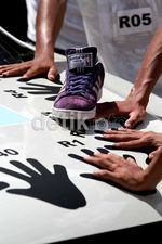 Peserta Subaru Palm Challenge Terbakar Matahari