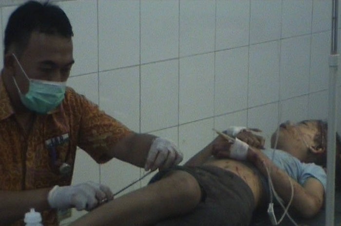 FK Undip Akan Gelar Doa Bersama untuk Korban Kecelakaan di Baturaden