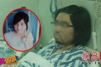 Wajah Si Cantik Jadi Berewokan Gara-gara Efek Samping Obat