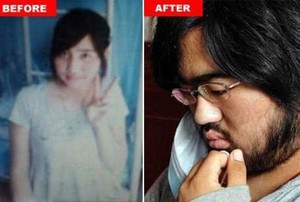 Ingin Obati Anemia, Wajah Gadis Ini Malah Ditumbuhi Kumis dan Janggut