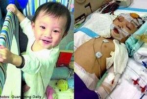 Balita Baru Umur 1 Tahun Tapi Sudah Kena Stroke