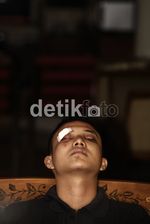 Dibogem Diego Michiels, Mef Cacat Sementara