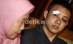 Dibogem Diego Michiels, Mef Cacat Sementara