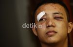Dibogem Diego Michiels, Mef Cacat Sementara