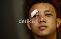 Mef mengaku pandangannya blur akibat pukulan dan tendangan yang dilakukan Diego.