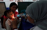 Seorang anak memeriksakan giginya.