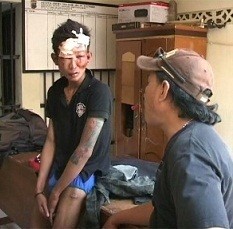 Ketahuan Mencuri, Suseno Babak Belur Dihajar Warga